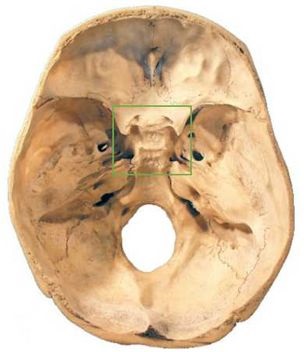 神经外科学 科普健康 【神外科普】——视力下降?小心鞍区肿瘤!